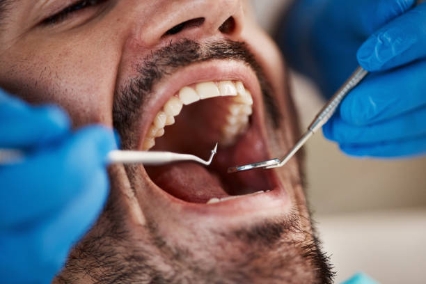 Best Weekend Emergency Dentist in Mountain Lakes, NJ